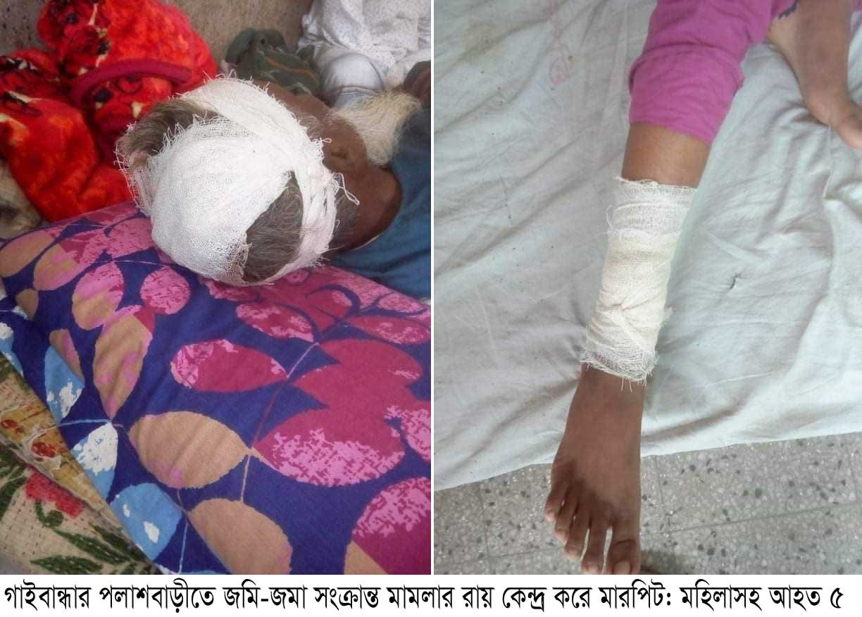 পলাশবাড়ীতে জমি-জমা সংক্রান্ত মামলার রায় কেন্দ্র করে মারপিট: মহিলাসহ আহত ৫ থানায় অভিযোগ দাখিল ।