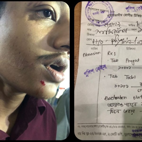 গাজীপুরের টঙ্গীতে ভয়াবহ হামলা, উত্তরা ইঞ্জিনিয়ারিং কলেজের ছাত্র আহত